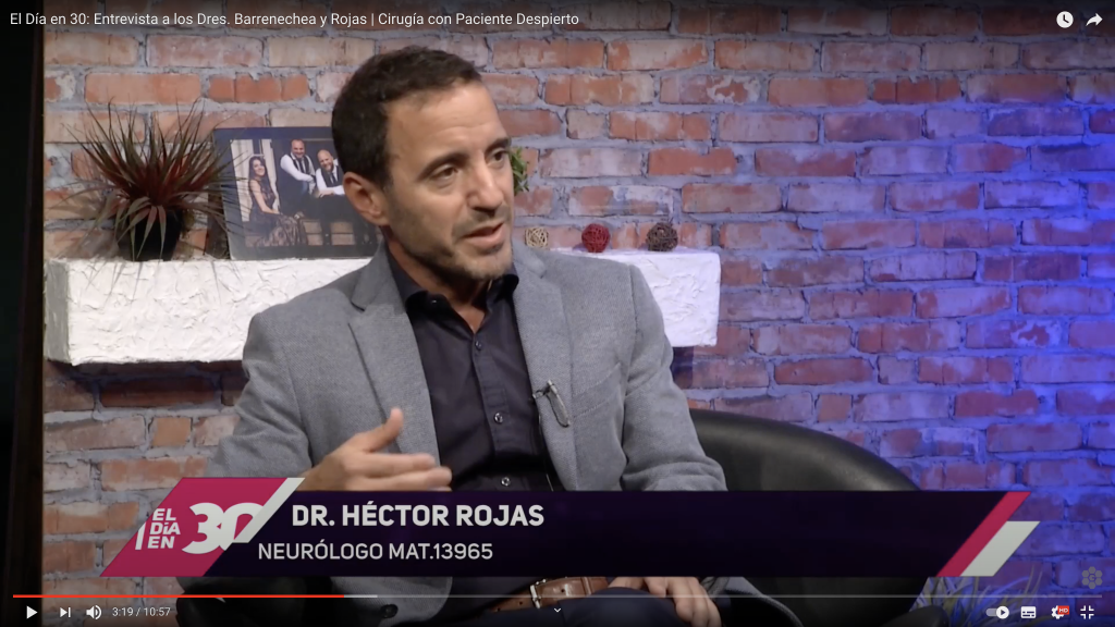 Entrevista Canal Rosario: tumores con paciente despierto