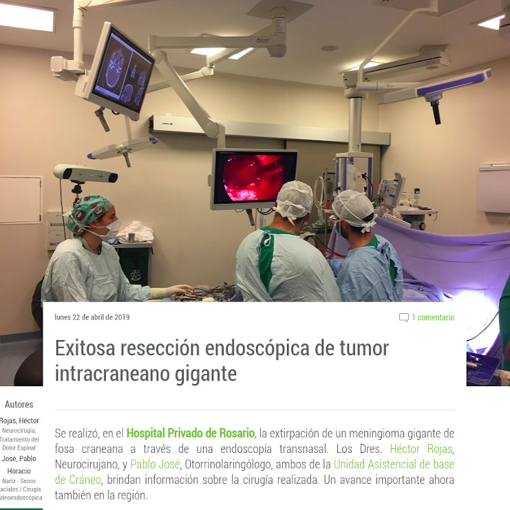 Exitosa resección endoscópica de tumor intracraneano gigante